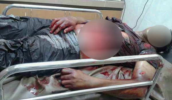 Salah satu korban pertikaian yang tewas