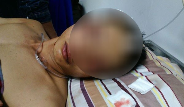 Iskandar, korban pengeryokan saat dirawat di rumah sakit