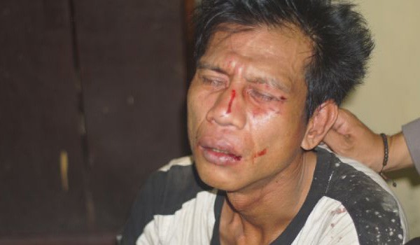 Pelaku curanmor yang diamuk massa