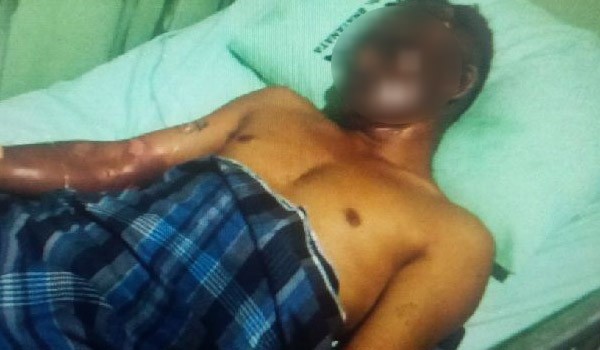 1 ABK kapal pengangkut BBM yang meledak