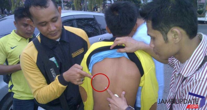 Salah satu murid MTsN Bangko menujukan bekas pukulan di punggungnya.