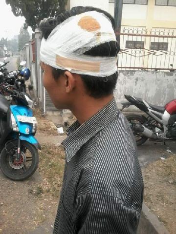 Mahasiswa yang mengalami luka di bagian kepala