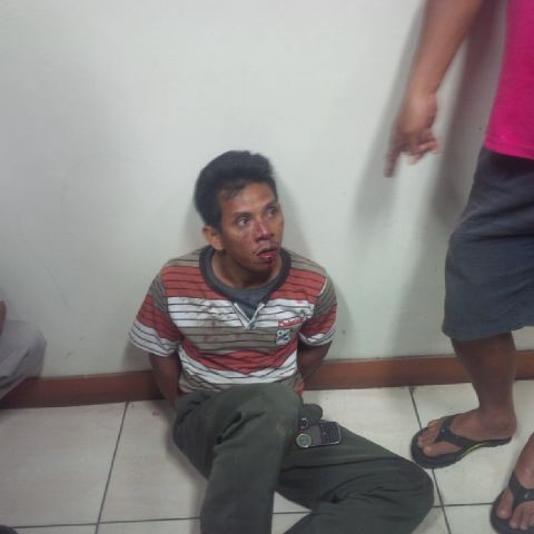 Iyan, pengemudi Honda Jazz saat di lokasi kejadian dengan kondisi babak belur