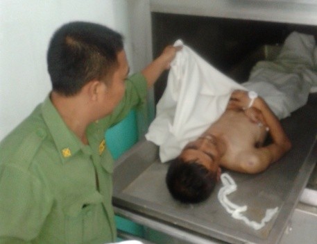 Salah satu petugas kamar jenazah RSUD Raden Mattaher memperlihatkan jasad Sandy Ismail (30)
