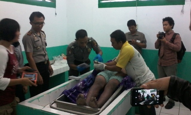 Jenazah Bima Sakti saat berada di kamar jenazah RSU Raden Mataher Jambi beberapa waktu lalu