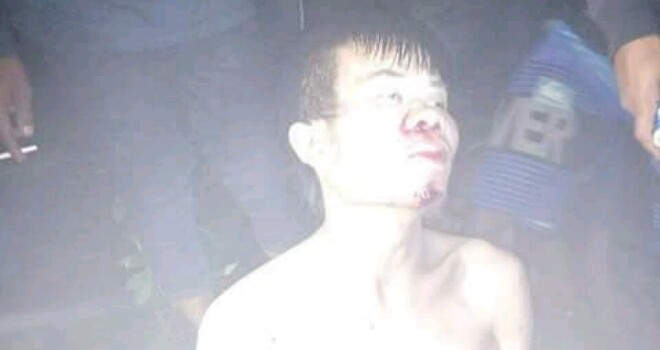 Pelaku yang babak belur di hajar.