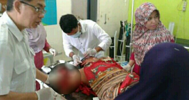 Kondisi korban dengan tangan kanan putus.