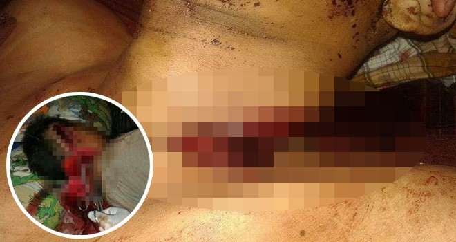 Korban pembacokan di Mandiangin