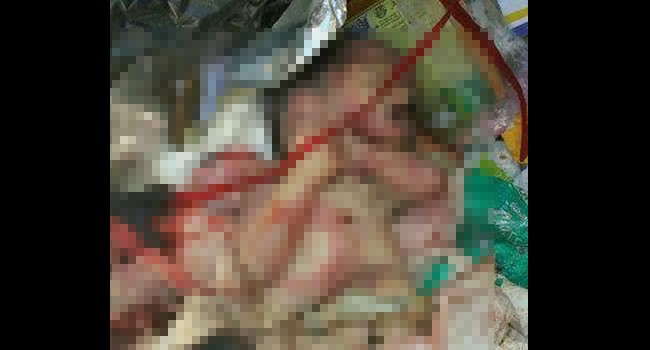 Bayi yang ditemukan ditempat pembuangan sampah.