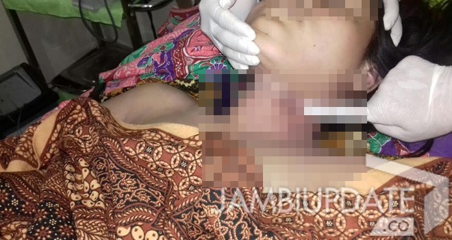 YC, gadis belia berusia 15 tahun korban gantung diri.