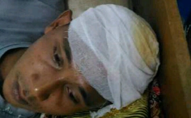 Ari Sugandi (25) korban pembacokan.