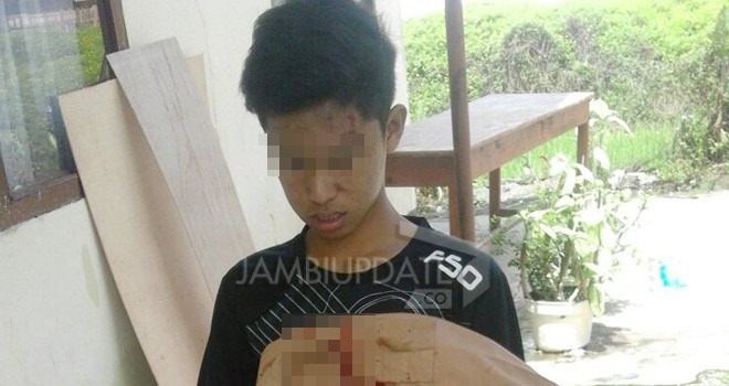 M Randi Putra (16), Siswa Sekolah Menengah Atas (SMA) 1 Kerinci yang babak belur usai dikeroyok.