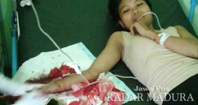 Busiyah, korban pembacokan dan perampasan, ketika berada di Puskesmas Kokop, Senin (20/2). (POLSEK KOKOP FOR Radar Madura.JawaPos.com)