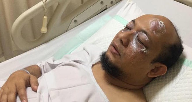 Penyidik senior KPK Novel Baswedan yang terbaring setelah disiram air keras oleh orang tak dikenal. (IST for JawaPos.com)