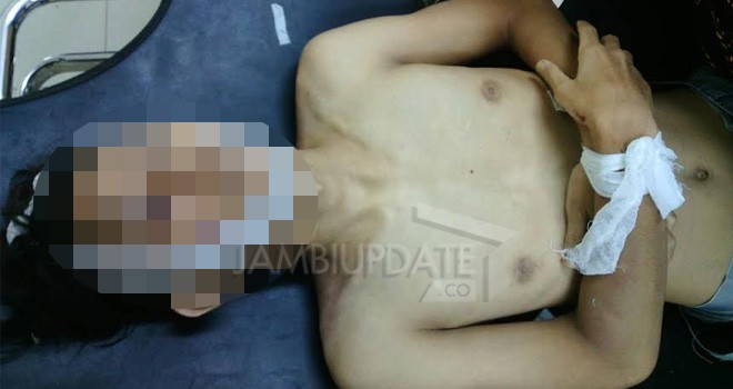 Irvan Saputra (22) tewas dilokasi kejadian setelah sepeda motornya bertabarakan dengan sebuah mobil di Bungo.