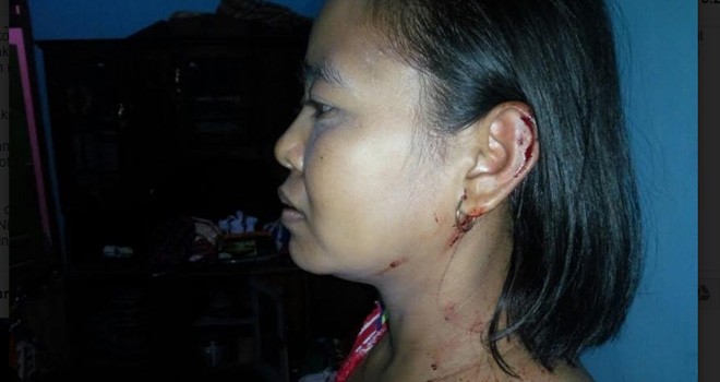 Korban perampokan Juwartini (35).