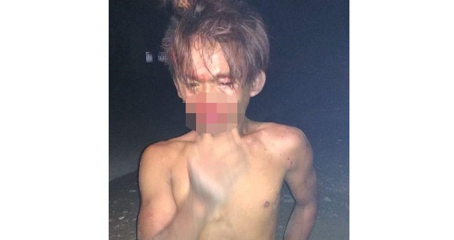 Terlihat diduga pelaku pencurian kulit manis yang babak belur dihabisi massa.