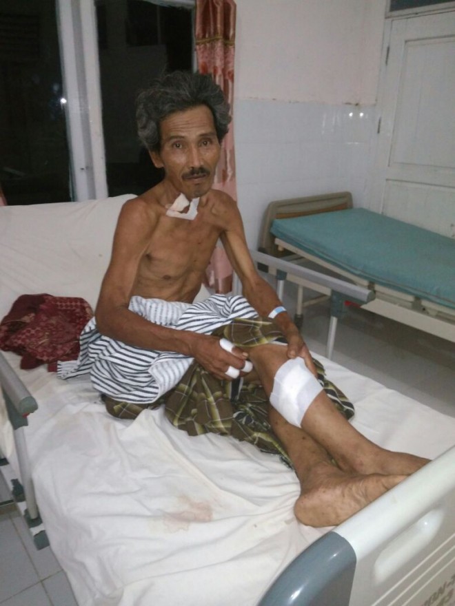 Korban Hariadi saat dirawat di rumah sakit. 