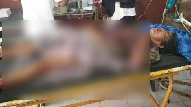 Perempuan di Bungo Kritis dengan Luka di Sekujur Tubuh Setelah Diseruduk Babi Hutan.
