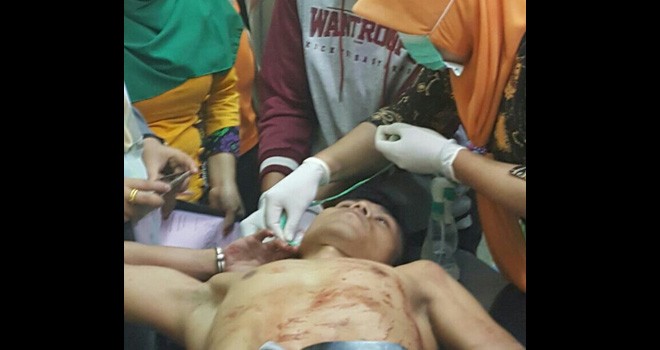 Epis Amris (32) warga Siulak Deras, Kecamatan Gunung Kerinci yang babak belur usai di amuk warga.