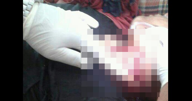 Ketua TPID Rasau yang Tewas Tersayat Egrek.