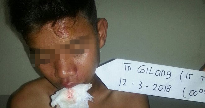 Siswa SMP di Ujung Pasir Babak Belur Hingga Tak Sadarkan Diri.