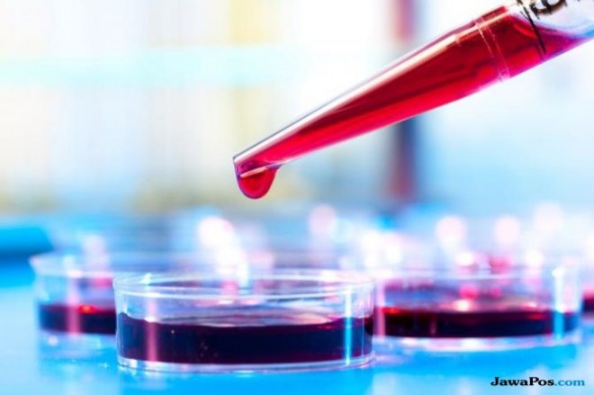 Ilustrasi darah kental. Pengentalan darah bisa dihindari dengan melakukan gaya hidup sehat. (tomorrowsci.com)