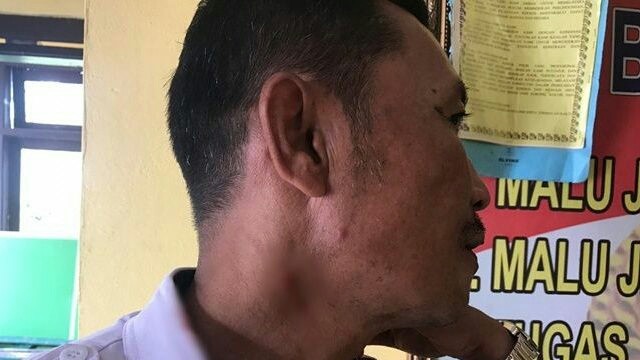 Kepala Sekolah SMAN 2 Rakit Hulu, Kabupaten Inhu, Riau, mengalami luka memar karena dianiaya oleh siswanya. (Istimewa)