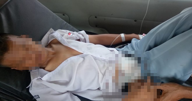 Salah seorang siswa SMA N 14 Merangin (IQ) mengalami luka di bagian perut akibat dari perkelahian dengan temannya (MS). Foto : Wiwin / Jambiupdate