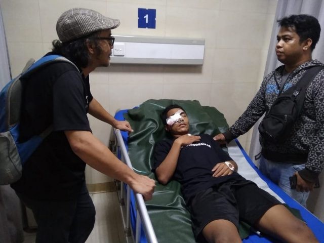 DALAM PERAWATAN: Anggriyanto Faisal yang mengalami luka di mata kanan. Kemarin dia menjalani operasi di RSUP dr Sardjito, Sleman. Johanes Sugianto (FOR JAWA POS RADAR JOGJA )