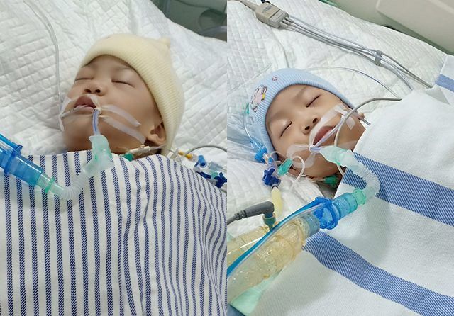 MASA KRITIS: Azila (kiri) dan Akila dirawat di ruang ICU kemarin (15/8). Akila sempat demam, tapi itu dianggap wajar oleh tim dokter. Kedua orang tua diminta untuk selalu menemani mereka.