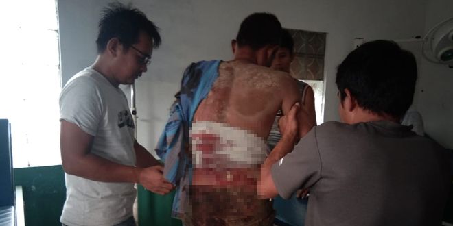 Ahmadi mengalami luka berat di bagian lengan sebelah kiri dan luka dibagian punggung setelah dibacok oleh Pendi.