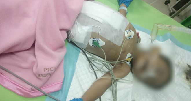 Wikar Fajar Alzaki terbaring di Ruang PICU Anak RSUD Raden Mattaher Jambi.


