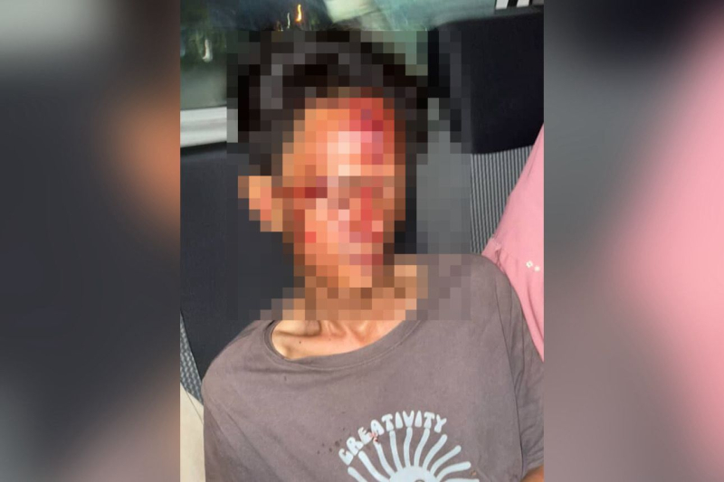 Viral di Medsos, Pria di Jambi Jadi Korban Pembacokan Usai Antar Wanita ke Pulau Pandan